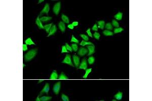Immunofluorescence analysis of A549 cells using GALE Polyclonal Antibody (GALE antibody)