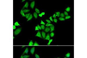 Immunofluorescence analysis of A549 cells using GALE Polyclonal Antibody (GALE antibody)