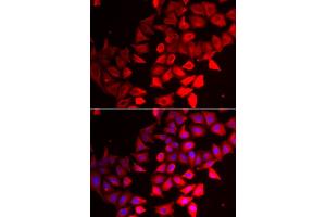 Immunofluorescence analysis of HeLa cells using CMPK1 antibody (ABIN5973940). (Cytidine Monophosphate (UMP-CMP) Kinase 1, Cytosolic (CMPK1) antibody)
