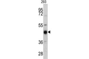 Western Blotting (WB) image for anti-Keratin 13 (KRT13) antibody (ABIN3002761) (Cytokeratin 13 antibody)