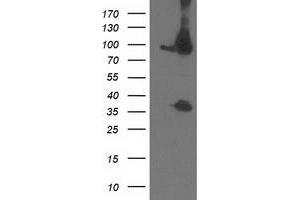 Western Blotting (WB) image for anti-Proteasome (Prosome, Macropain) 26S Subunit, Non-ATPase, 2 (PSMD2) antibody (ABIN1500480)