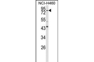 Western blot analysis of SPG20 Antibody (N-term) (ABIN652983 and ABIN2842623) in NCI- cell line lysates (35 μg/lane).