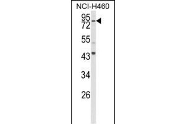 SPG20 anticorps  (N-Term)