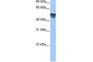 WB Suggested Anti-WASF3 Antibody Titration: 0. (WASF3 antibody  (Middle Region))