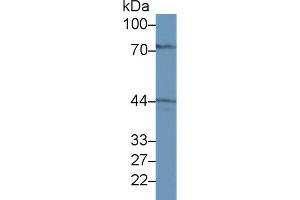 Western blot analysis of Rat Liver lysate, using Rat GALT Antibody (1 µg/ml) and HRP-conjugated Goat Anti-Rabbit antibody ( (GALT antibody  (AA 1-379))