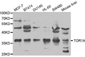 Western blot analysis of extracts of various cell lines, using TOR1A antibody. (TOR1A antibody  (AA 63-332))