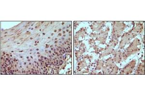 Immunohistochemical staining of paraffin-embedded human normal esophagus (A) and stomach (B) tissue, showing nucleus localization using Rb mouse mAb with DAB staining.
