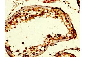 IHC image of ABIN7154533 diluted at 1:200 and staining in paraffin-embedded human testis tissue performed on a Leica BondTM system. (GDF1 antibody  (AA 369-478))