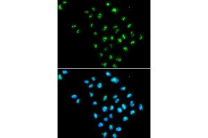 Immunofluorescence analysis of MCF7 cell using EIF6 antibody.