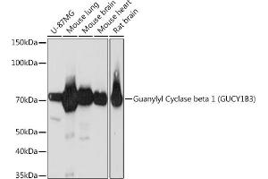 Western blot analysis of extracts of various cell lines, using Guanylyl Cyclase beta 1 (GUCY1B3) (GUCY1B3) Rabbit mAb (ABIN7267551) at 1:1000 dilution. (GUCY1B3 antibody)