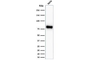 Western Blot Analysis of HeLa cell lysate using Beta-Catenin Recombinant Rabbit Monoclonal Antibody (CTNNB1/2030R). (Recombinant CTNNB1 antibody)
