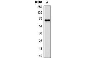 Western blot analysis of PAK1 (pT212) expression in HCT116 (A) whole cell lysates.
