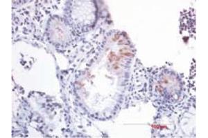 Immunohistochemistry image of B-Defensin 2 staining in paraffn section of human colon resection tissue. (beta 2 Defensin antibody  (AA 4-41))