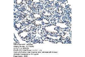 Human Lung (NRF1 antibody  (C-Term))