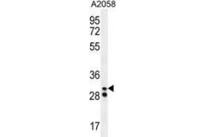 Western blot analysis in A2058 cell line lysates (35ug/lane) using Neutrophil elastase  Antibody (N-term). (ELANE antibody  (N-Term))