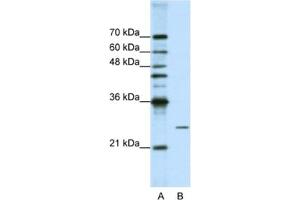 Western Blotting (WB) image for anti-Processing of Precursor 4, Ribonuclease P/MRP Subunit (POP4) antibody (ABIN2462223) (RPP29 antibody)
