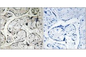 Immunohistochemistry analysis of paraffin-embedded human placenta tissue, using CYB5R3 Antibody. (CYB5R3 antibody  (AA 137-186))