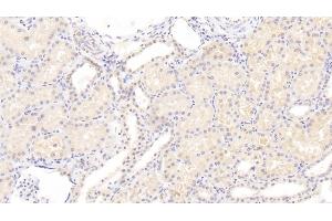 Detection of AMFR in Human Kidney Tissue using Polyclonal Antibody to Autocrine Motility Factor Receptor (AMFR) (AMFR antibody  (AA 456-643))