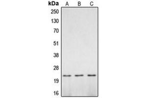 Western blot analysis of Caspase 2 p18 expression in mouse brain (A), rat brain (B), PC12 UV-treated (C) whole cell lysates. (Caspase 2 p18 antibody  (Center))