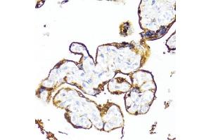 Immunohistochemistry of paraffin-embedded human placenta using HSD17B1 antibody (ABIN6129829, ABIN6142002, ABIN6142003 and ABIN6215013) at dilution of 1:100 (40x lens). (HSD17B1 antibody  (AA 1-328))