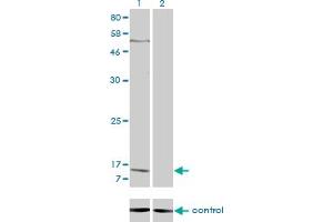Western blot analysis of PPBP over-expressed 293 cell line, cotransfected with PPBP Validated Chimera RNAi (Lane 2) or non-transfected control (Lane 1). (CXCL7 antibody  (AA 37-128))