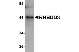 Western blot analysis of RHBDD3 in rat lung tissue lysate with RHBDD3 antibody at 1 µg/mL. (RHBDD3 antibody  (Middle Region))