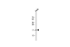Anti-PTP4A2 Antibody (Center) at 1:1000 dilution + Hela whole cell lysate Lysates/proteins at 20 μg per lane.
