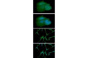 ICC/IF analysis of ARF1 in MCF7 cell line, stained with DAPI (Blue) for nucleus staining and monoclonal anti-human ARF1 antibody (1:100) with goat anti-mouse IgG-Alexa fluor 488 conjugate (Green). (ARF1 antibody  (AA 1-181))