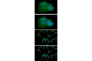 ICC/IF analysis of ARF1 in MCF7 cell line, stained with DAPI (Blue) for nucleus staining and monoclonal anti-human ARF1 antibody (1:100) with goat anti-mouse IgG-Alexa fluor 488 conjugate (Green).