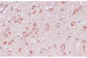 Immunohistochemistry of paraffin-embedded Rat brain using RPL32 Polyclonal Antibody at dilution of 1:100 (40x lens).