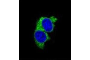 Confocal immunofluorescent analysis of MMP1 Antibody (Center) Cat. (MMP1 antibody  (Middle Region))