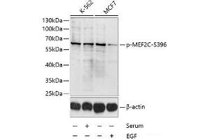 Western blot analysis of extracts of K-562 and MCF-7 cells using Phospho-MEF2C(S396) Polyclonal Antibody at dilution of 1:1000. (MEF2C antibody  (pSer396))