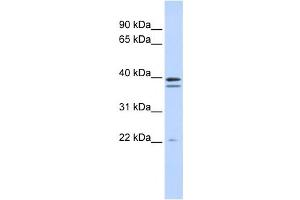 Western Blotting (WB) image for anti-Rab Geranylgeranyltransferase, beta Subunit (RABGGTB) antibody (ABIN2459215) (RABGGTB antibody)