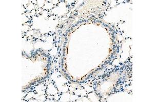 Immunohistochemistry of paraffin embedded mouse pneumonia using B3GALT4 (ABIN7073157) at dilution of 1:400 (300x lens) (ATP6V1C2 antibody)