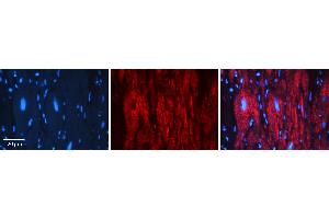 Rabbit Anti-PEA15 Antibody   Formalin Fixed Paraffin Embedded Tissue: Human heart Tissue Observed Staining: Cytoplasmic Primary Antibody Concentration: 1:100 Other Working Concentrations: N/A Secondary Antibody: Donkey anti-Rabbit-Cy3 Secondary Antibody Concentration: 1:200 Magnification: 20X Exposure Time: 0. (PEA15 antibody  (Middle Region))