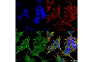 Immunocytochemistry/Immunofluorescence analysis using Mouse Anti-GluN2A/NR2A Monoclonal Antibody, Clone S327-95 . (NMDAR2A antibody  (AA 75-325) (HRP))