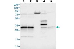 Western blot analysis of Lane 1: RT-4, Lane 2: U-251 MG, Lane 3: Human Plasma, Lane 4: Liver, Lane 5: Tonsil with MRPL45 polyclonal antibody  at 1:250-1:500 dilution. (MRPL45 antibody)