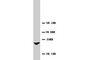 Western blot analysis of rat liver tissue lysate. (GJB2 antibody  (AA 1-16))