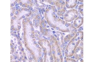 Immunohistochemistry of paraffin-embedded Rat kidney using ACAA1 Polyclonal Antibody at dilution of 1:100 (40x lens). (ACAA1 antibody)