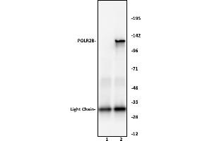 POLR2B antibody (pAb) tested by Immunoprecipitation. (POLR2B antibody  (N-Term))