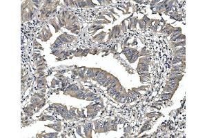 IHC analysis of PDE6 alpha/PDE6A using anti-PDE6 alpha/PDE6A antibody (ABIN7599710). (PDE6A antibody  (AA 11-237))