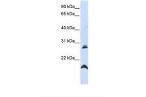 Image no. 1 for anti-Spermatogenesis Associated 9 (SPATA9) (N-Term) antibody (ABIN6738659) (SPATA9 antibody  (N-Term))