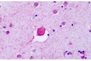 Anti-P2RY8 antibody IHC staining of human brain, cortex. (P2RY8 antibody  (Cytoplasmic Domain))