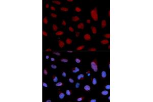 Immunofluorescence analysis of U2OS cells using TNNC1 antibody (ABIN5970992). (TNNC1 antibody)