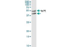 Immunoprecipitation of FANCL transfected lysate using anti-FANCL MaxPab rabbit polyclonal antibody and Protein A Magnetic Bead , and immunoblotted with FANCL MaxPab rabbit polyclonal antibody (D01) . (FANCL antibody  (AA 1-375))