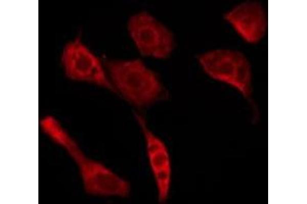 OR52A5 antibody  (Internal Region)