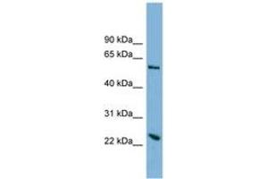 Image no. 1 for anti-Transmembrane Protein 161A (TMEM161A) (AA 179-228) antibody (ABIN6742031) (TMEM161A antibody  (AA 179-228))