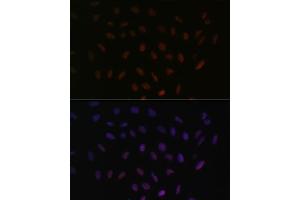 Immunofluorescence analysis of U-2 OS cells using SRSF3 antibody (ABIN6132649, ABIN6148465, ABIN6148466 and ABIN6221693) at dilution of 1:100. (SRSF3 antibody  (AA 1-90))