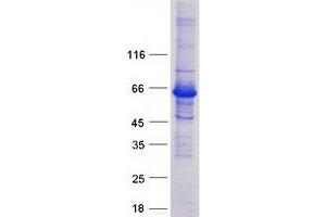 Western Blotting (WB) image for EPM2A (Laforin) Interacting Protein 1 (EPM2AIP1) protein (Myc-DYKDDDDK Tag) (ABIN2720306)