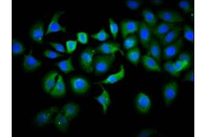 Immunofluorescence staining of A549 cells with ABIN7163552 at 1:133, counter-stained with DAPI. (PLS1 antibody  (AA 1-143))